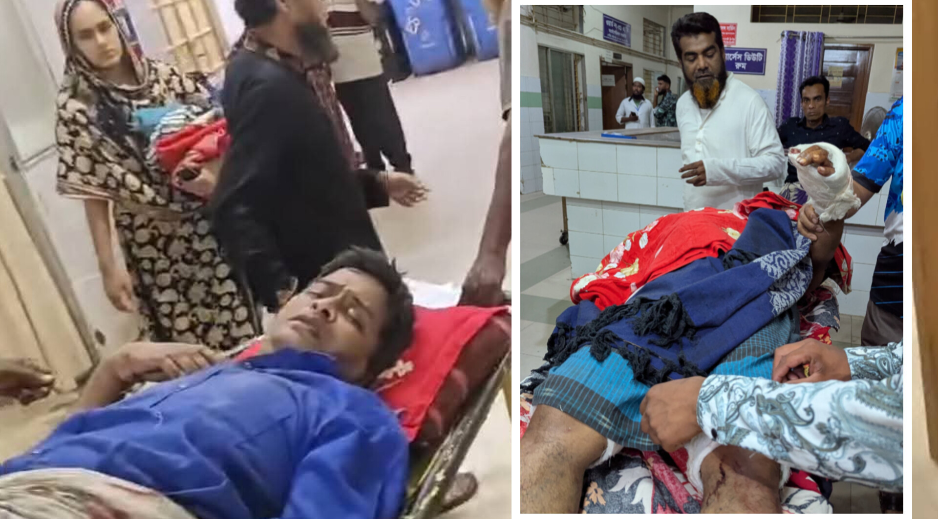 চুরি মামলা তুলে না নেয়ায় সাংবাদিককে কুপিয়ে জখম-আঙুল বিচ্ছিন্ন
